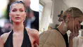 Bella Hadid, Lyme hastalığıyla mücadelesini paylaştı: Hep ortadan kayboluyorum