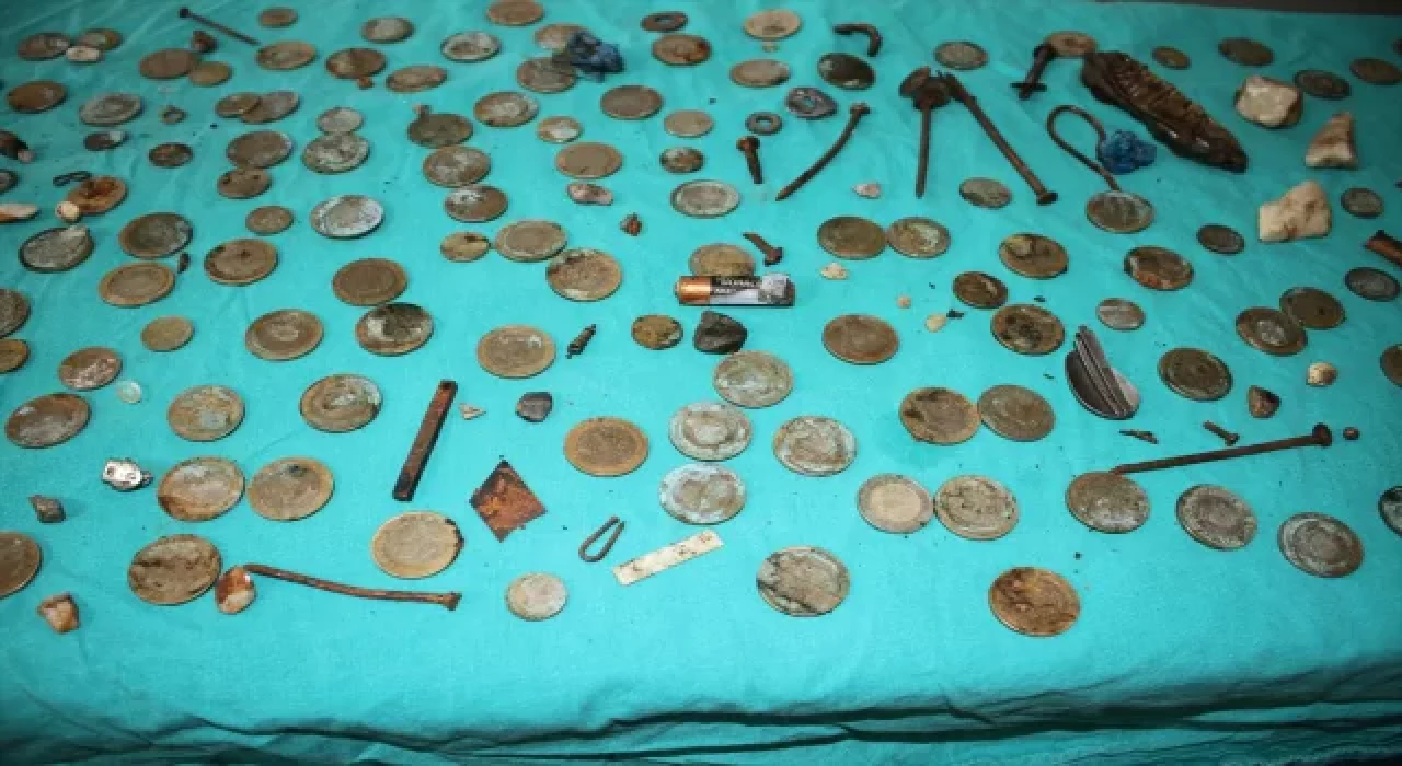 Midesinden 233 parça yabancı cisim çıkarılan hasta sağlığına kavuştu