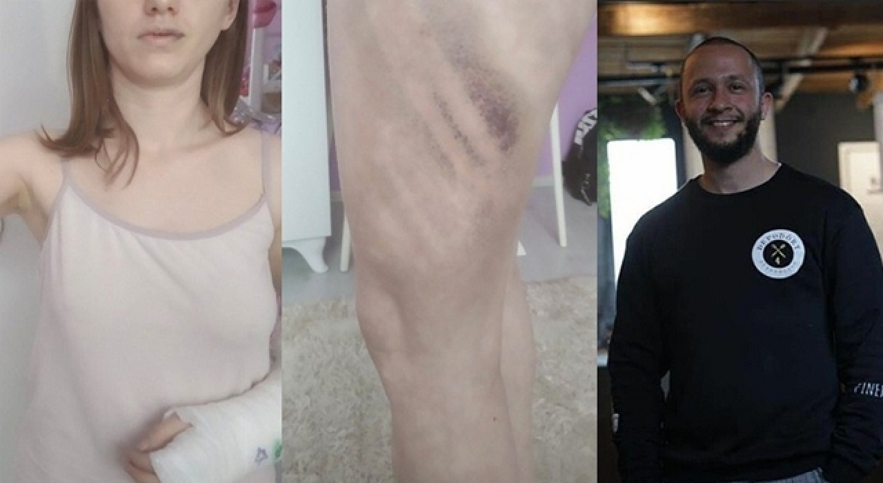 Kız arkadaşını beyzbol sopasıyla darp eden erkek tutuklandı