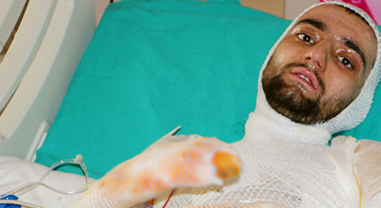 Sobaya benzin dökünce yandı