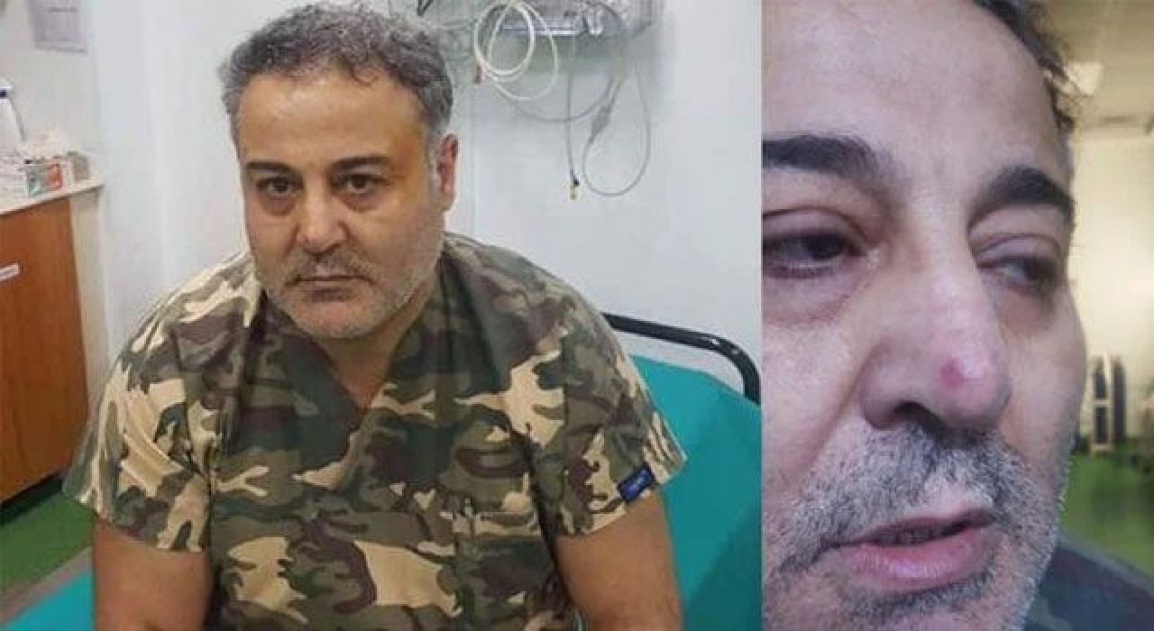 Hasta yakınının yumruklu saldırısı sonucu doktor yaralandı