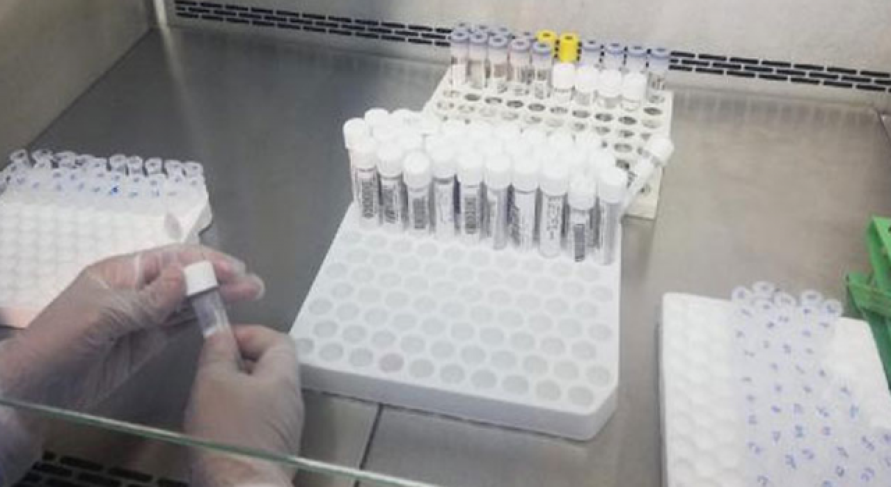 Koronavirüs tanılarının yüzde 95'i İngiltere mutasyonu