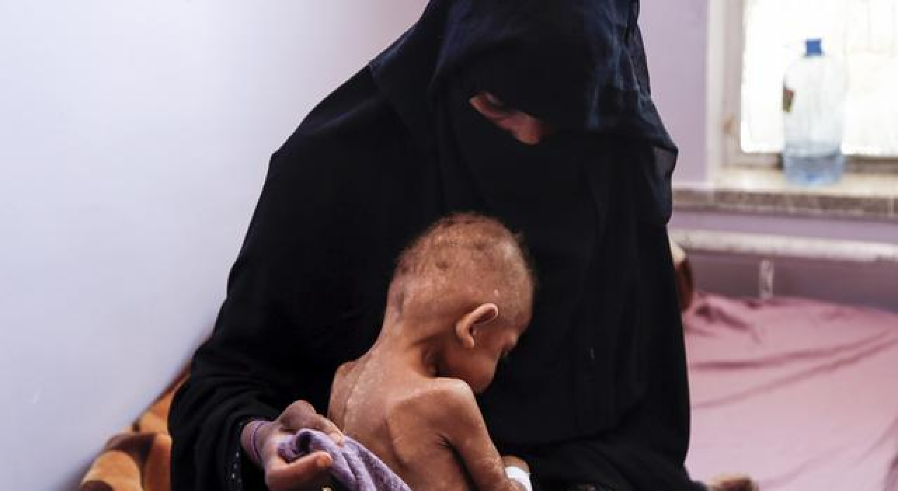 Milyonlarca insan açlıktan ölme tehlikesiyle karşı karşıya