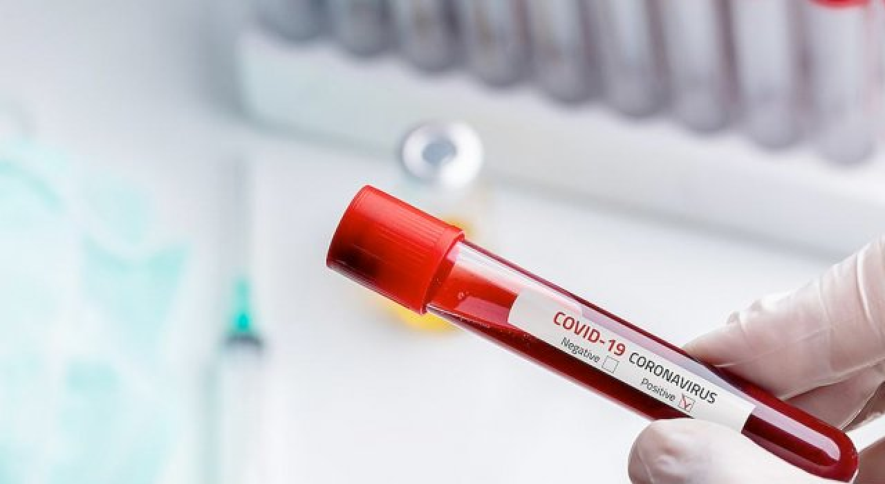 Ortak flüt kullandılar: 14 kişi pozitif çıktı