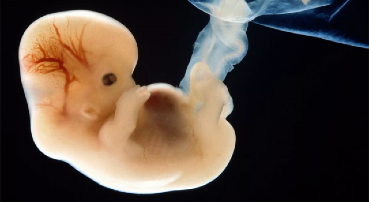 İnsan embriyo beynini laboratuvarda üretip bir yıl yaşattılar