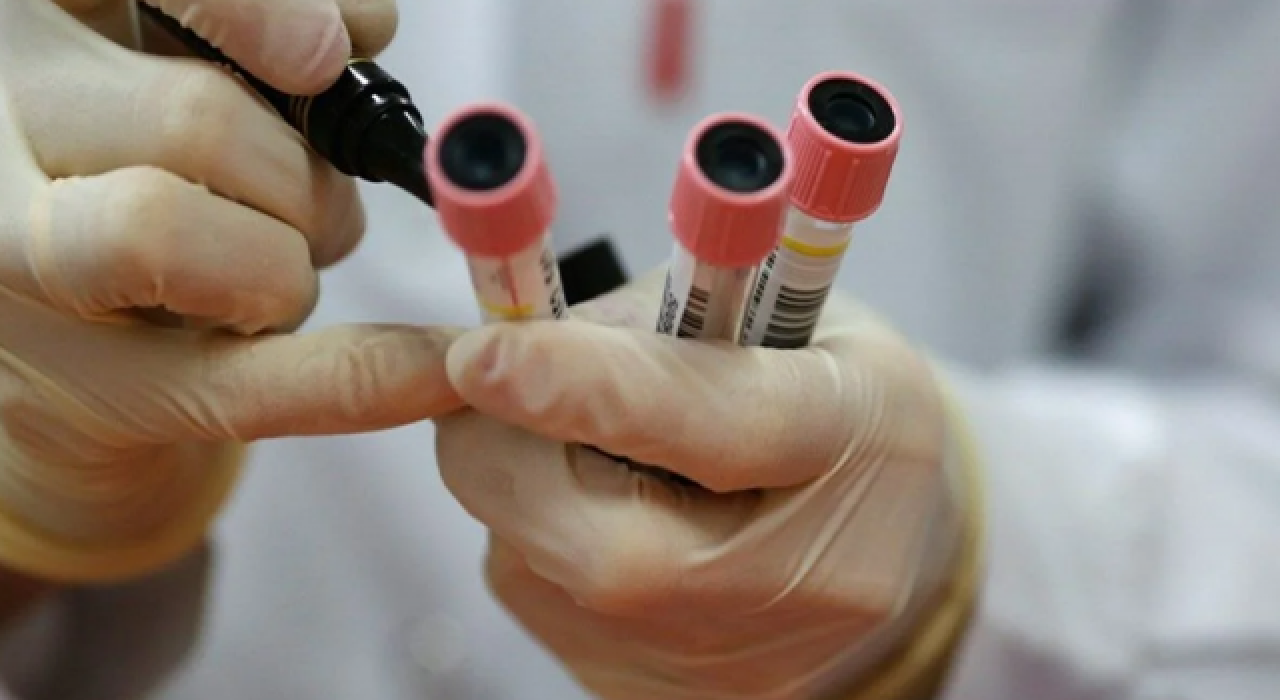 Birleşik Krallık'ta her gün binlerce kişiye antikor testi yapılacağı duyuruldu!