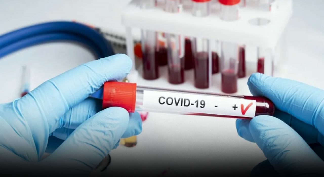 Hukukçular yanıtladı: PCR testi "zorunlu" tutabilir mi?