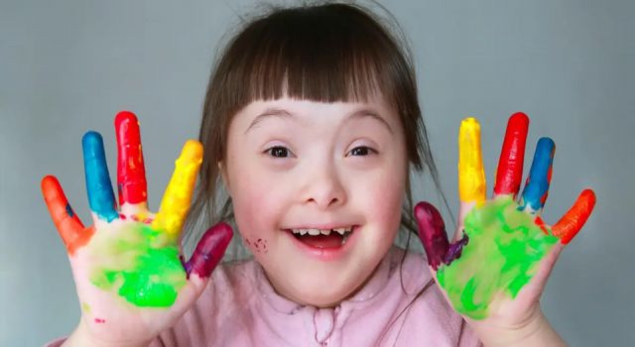 Down sendromu nedir? Down sendromu belirtileri nelerdir?