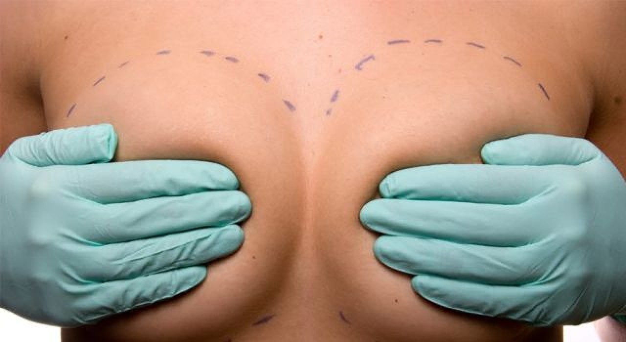 Meme büyütme işlemi süt kanallarına zarar verir mi?