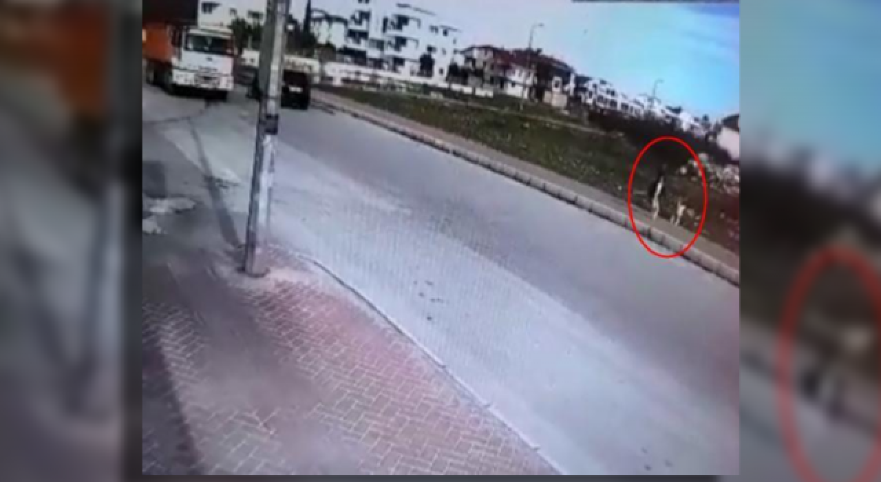 Sokak köpeği saldırısından kaçan küçük Mahra, bacağını kaybetti