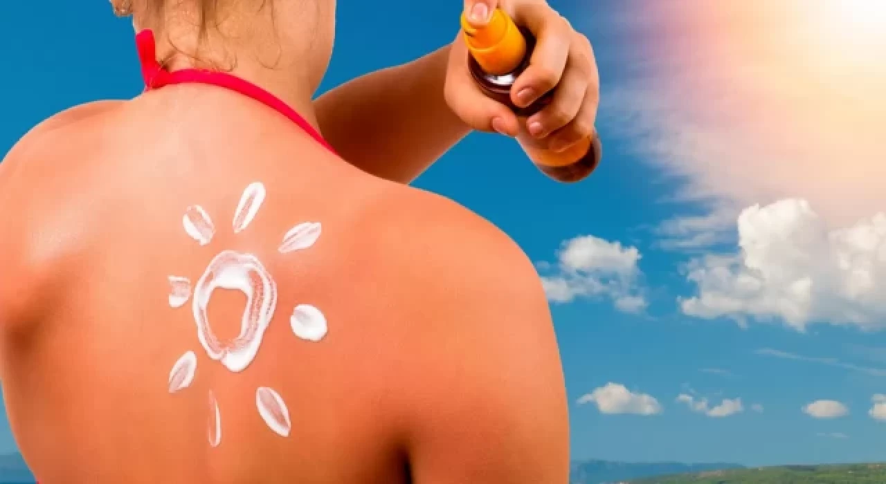 Güneş yanığına ne iyi gelir?