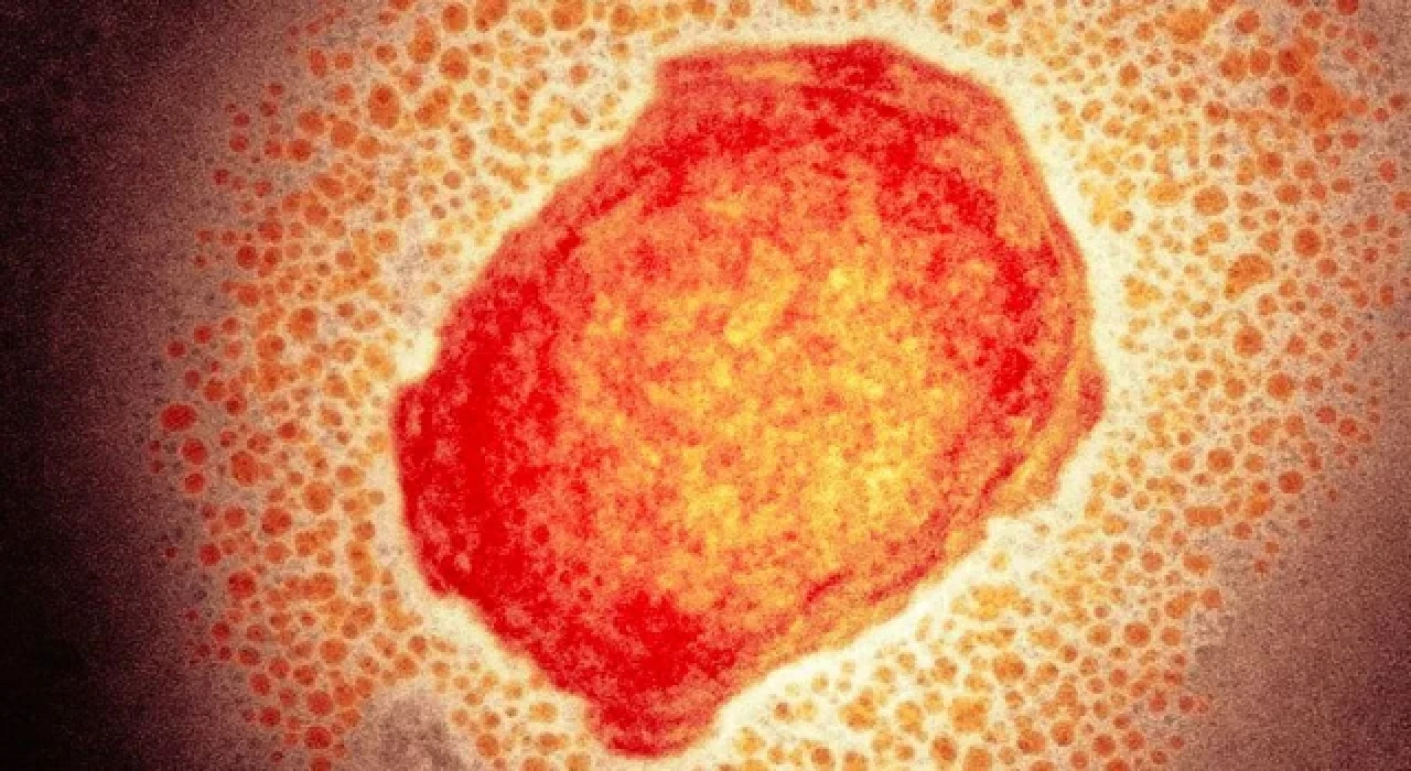 DSÖ Acil Durum Komitesi, maymun çiçeği virüsü için bir araya geldi