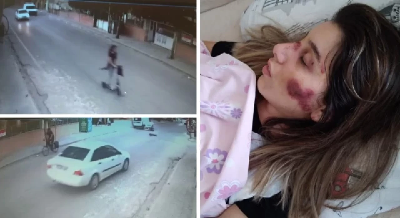 Ters yönde giren otomobil, scooter kullanan kadına çarptı