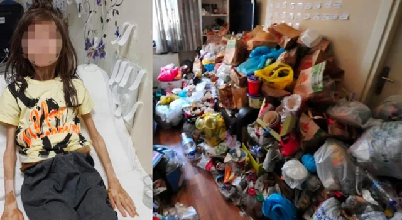 Bursa'daki çöp evde bulunan çocuk taburcu edildi