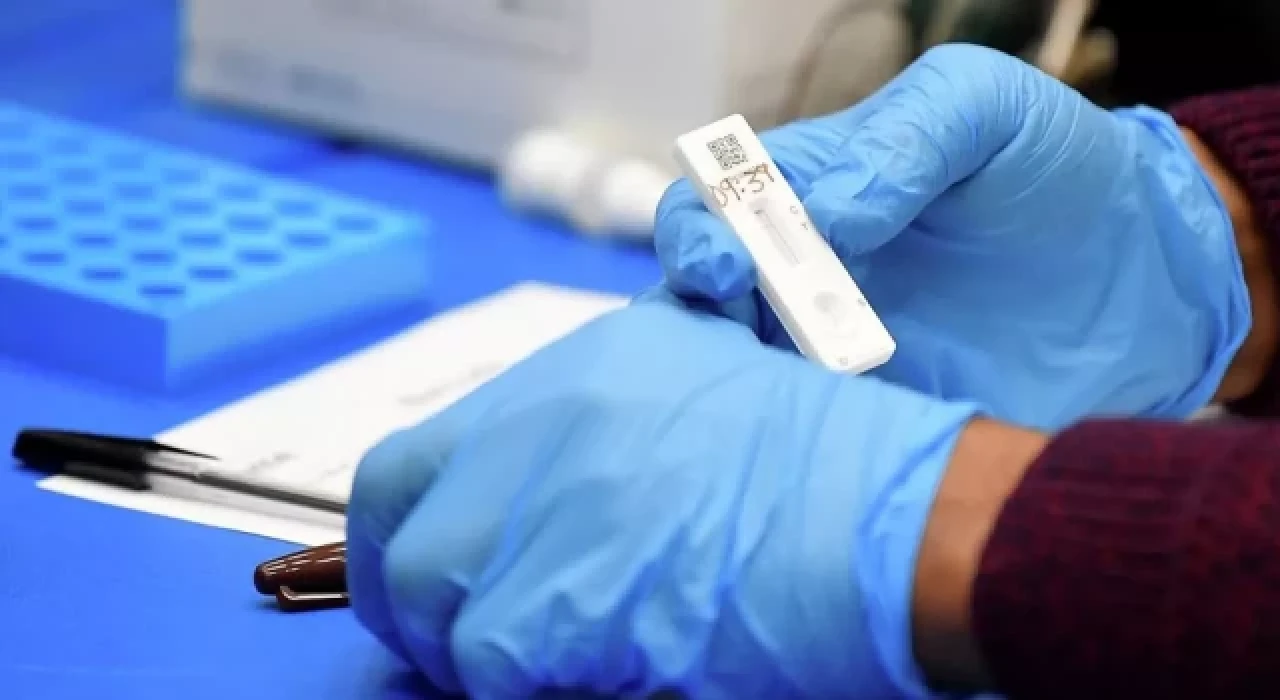 Dünyada bir ilk: Maymun çiçeği, Kovid-19 ve HIV aynı anda pozitif çıktı