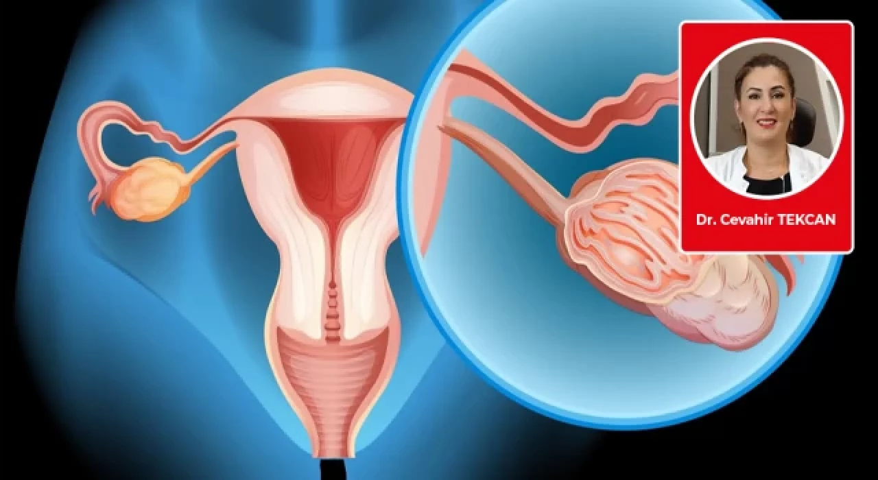 Düşük yumurtalık rezervi menopozun göstergesi midir?