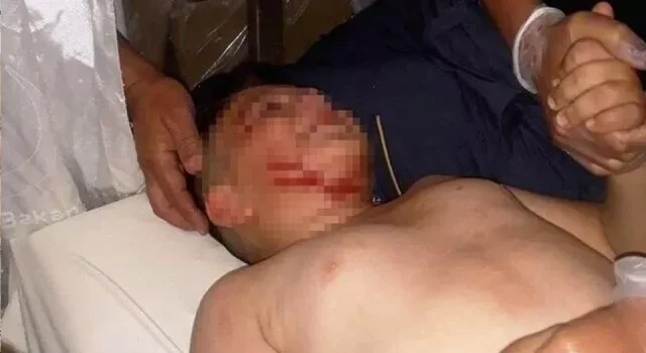 Sahipsiz köpeğin saldırdığı çocuğa 40 dikiş atıldı