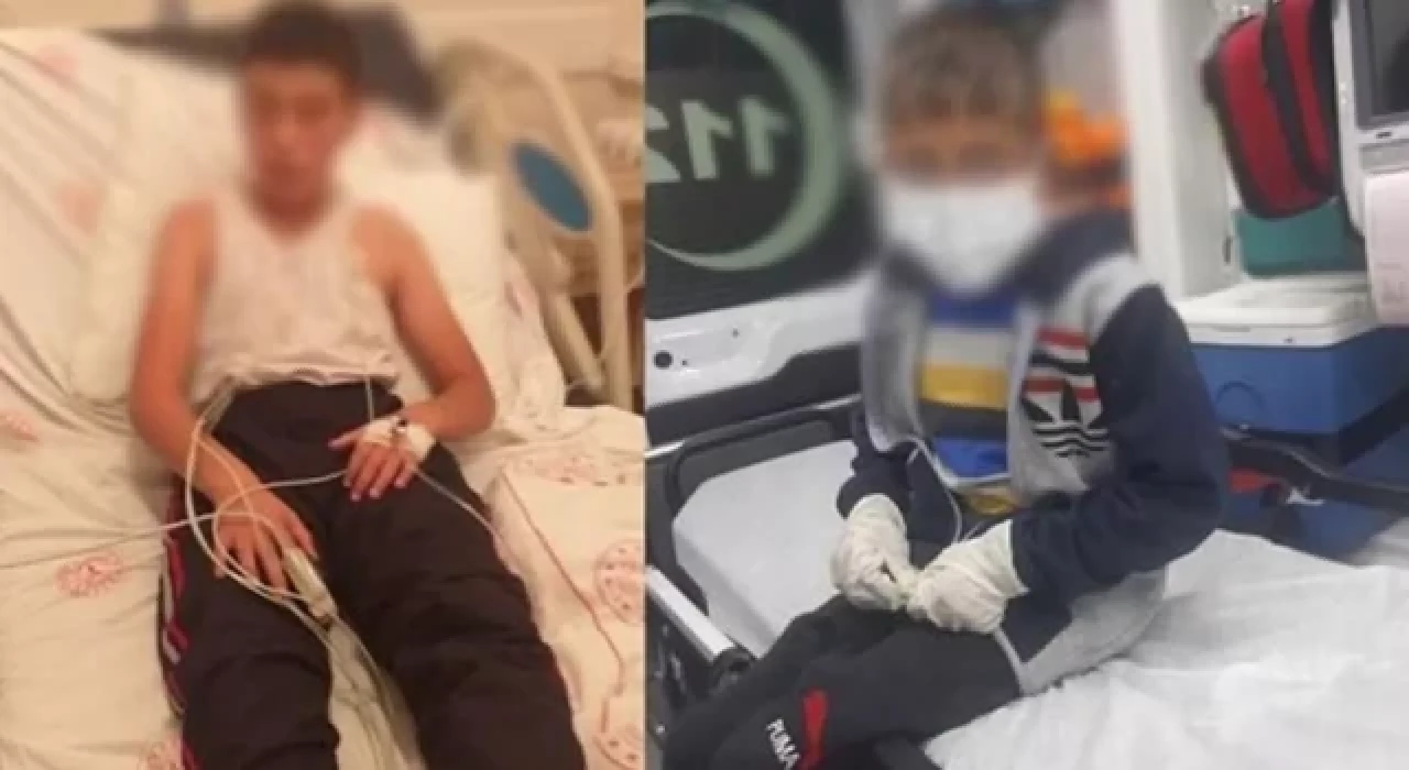 Bitlis'te köpeğin ısırdığı iki çocuktan biri kuduz oldu