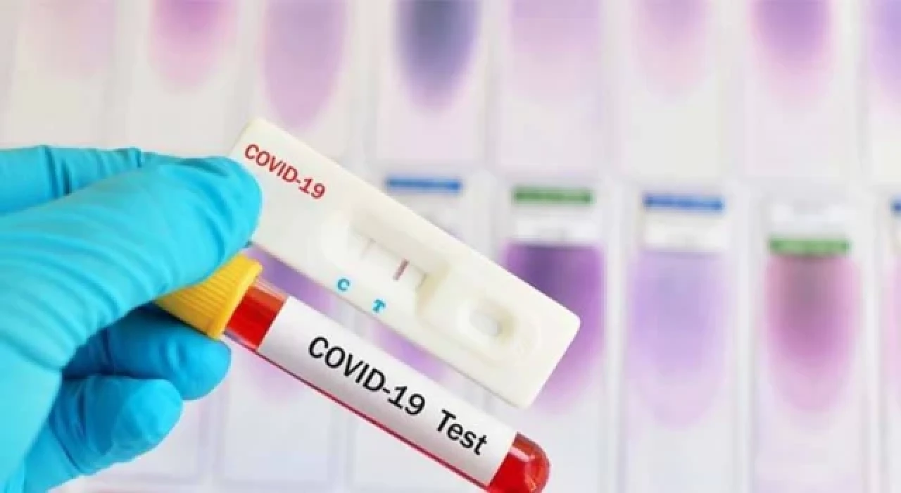 İddia: ”Covid-19 sebebiyle ölenlerin beyninde virüs saptandı”