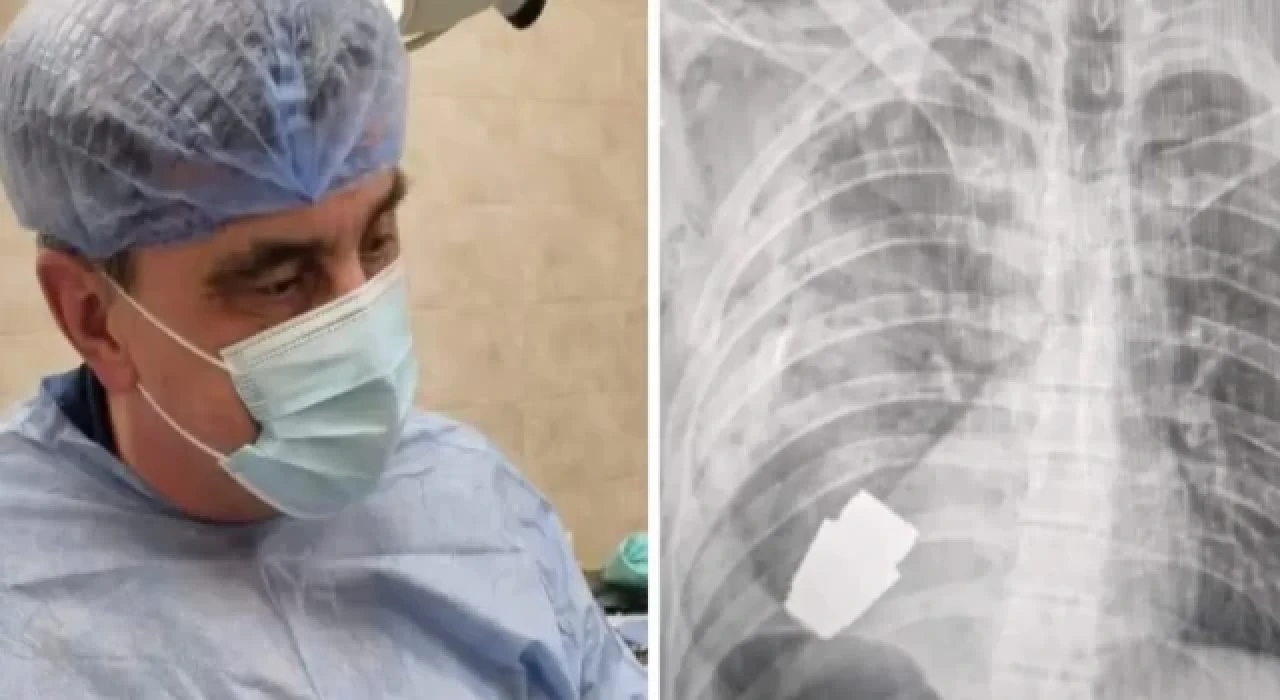 Ukraynalı askerin göğsünden patlamamış el bombası çıkarıldı!