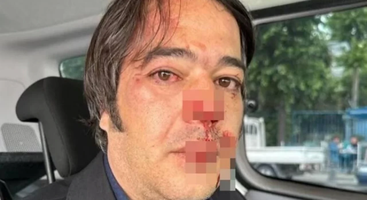 İBB'nin imar şube müdürüne saldırıda tutuklanan şüpheli serbest bırakıldı