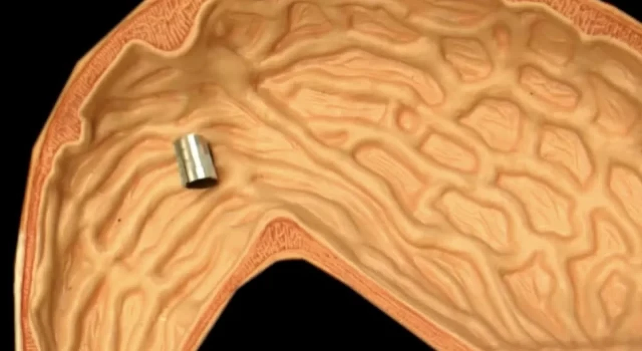 İnsan vücudu içinde yüzebilen minik bir robot geliştirildi