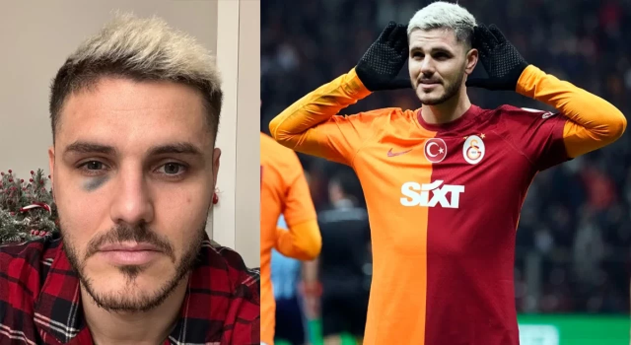 Galatasaray'dan Icardi'nin durumuna ilişkin açıklama geldi