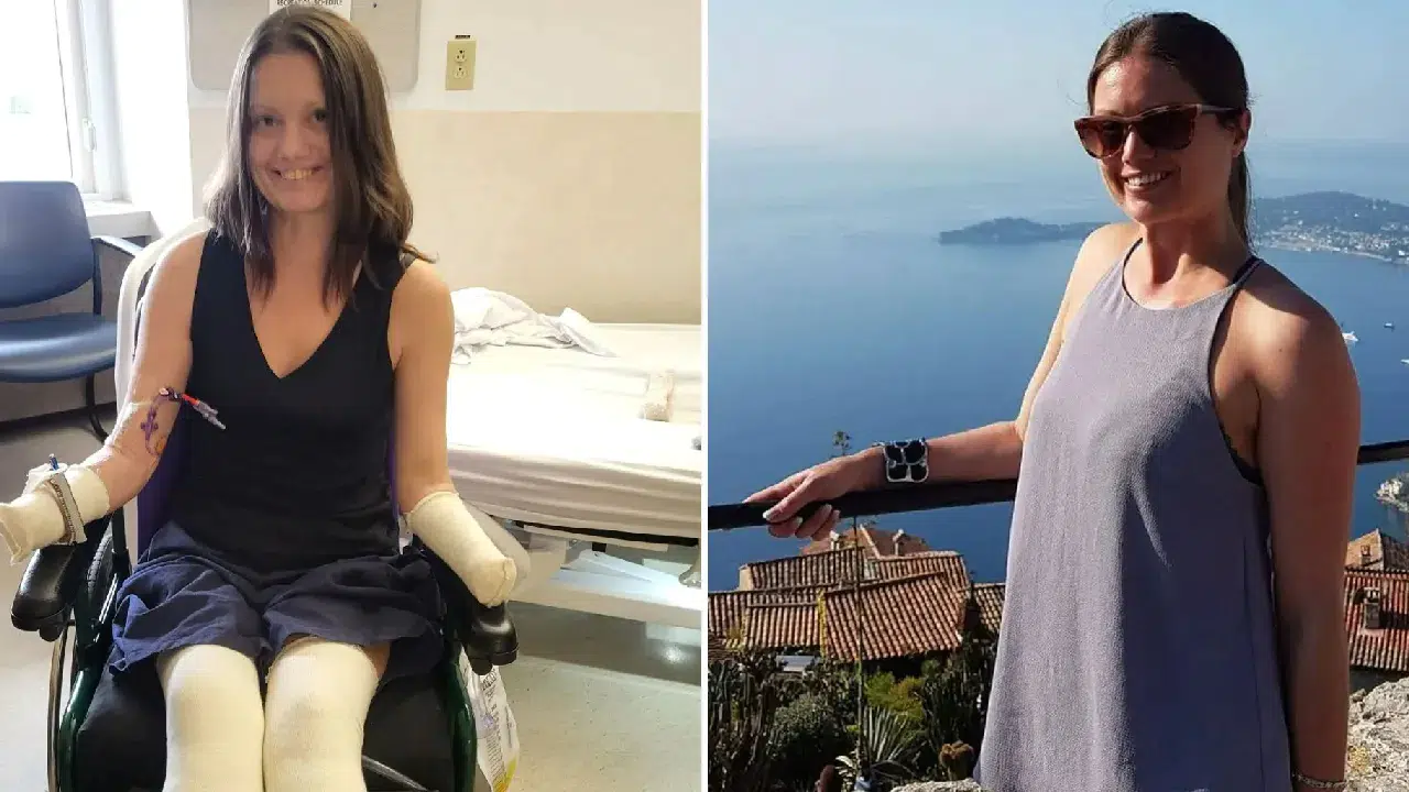 Korkunç vaka: Yanağındaki ağrı uzuvlarının kesilmesine yol açtı