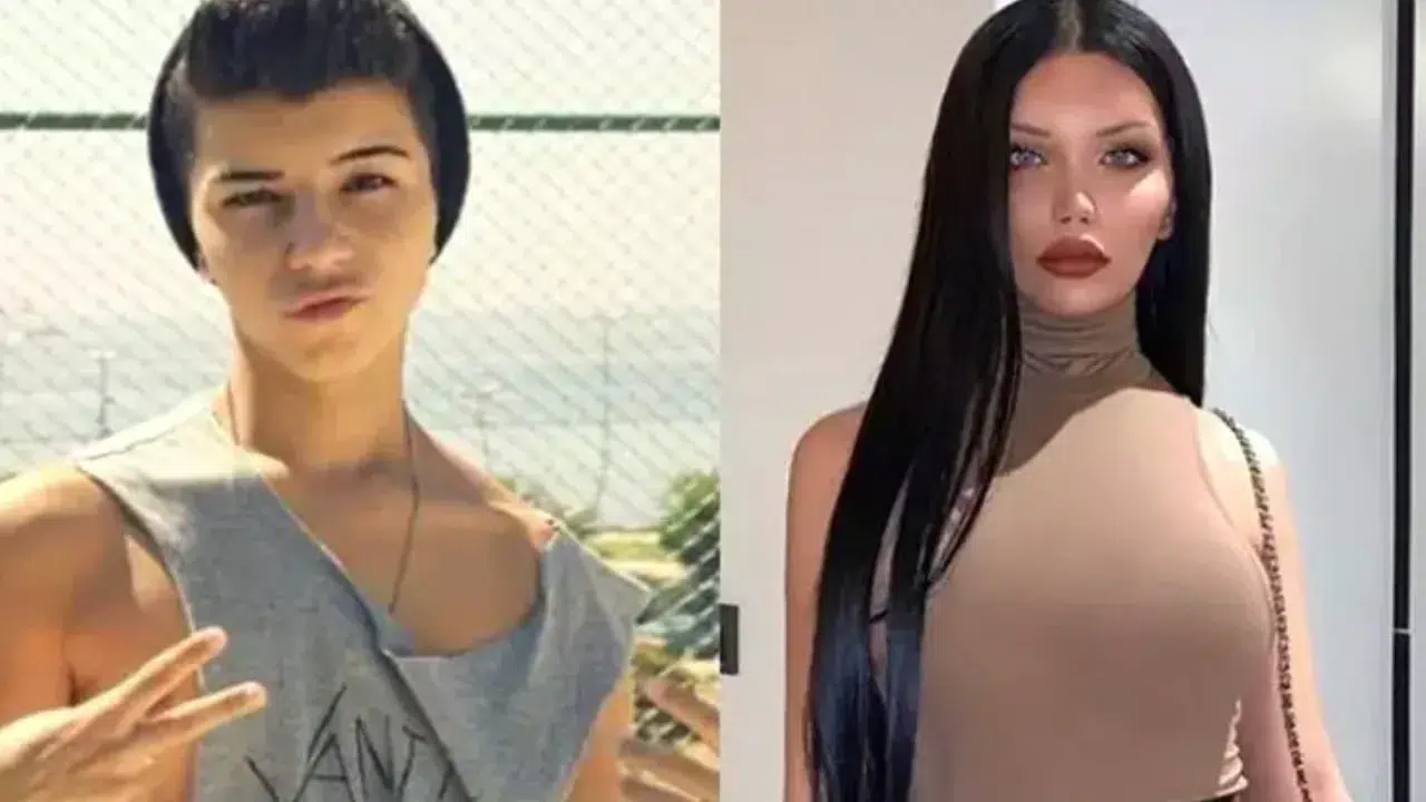 Cinsiyet değiştiren fenomen Beren Güney’den dikkat çeken estetik itirafı: Kemik eklettim