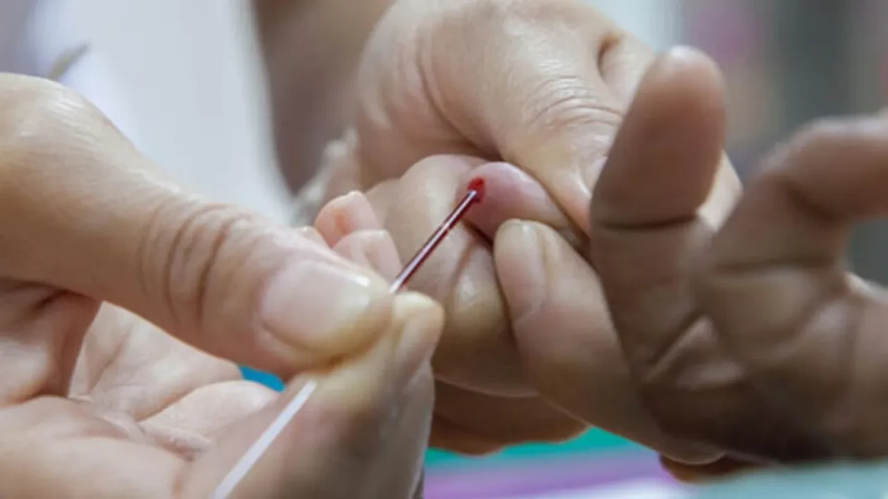 Akdeniz Anemisi (Thalassemia) belirtileri, tanısı ve tedavi yöntemleri nelerdir?