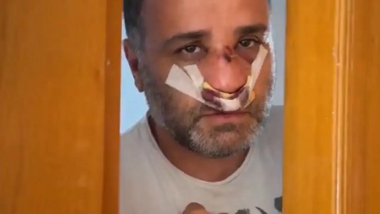 Marmaray'da çocuklarının yanında saldırıya uğrayan babadan ilk açıklama