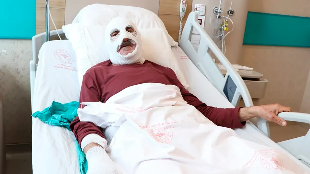 Gaz kaçağına çakmakla bakmak isteyen 76 yaşındaki adam evini ve vücudunu yaktı!