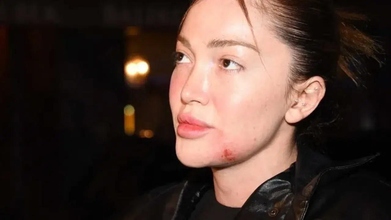 Danla Bilic'e şiddet uygulayan eski sevgilisi Berk Çetin'den ölüm tehdidi