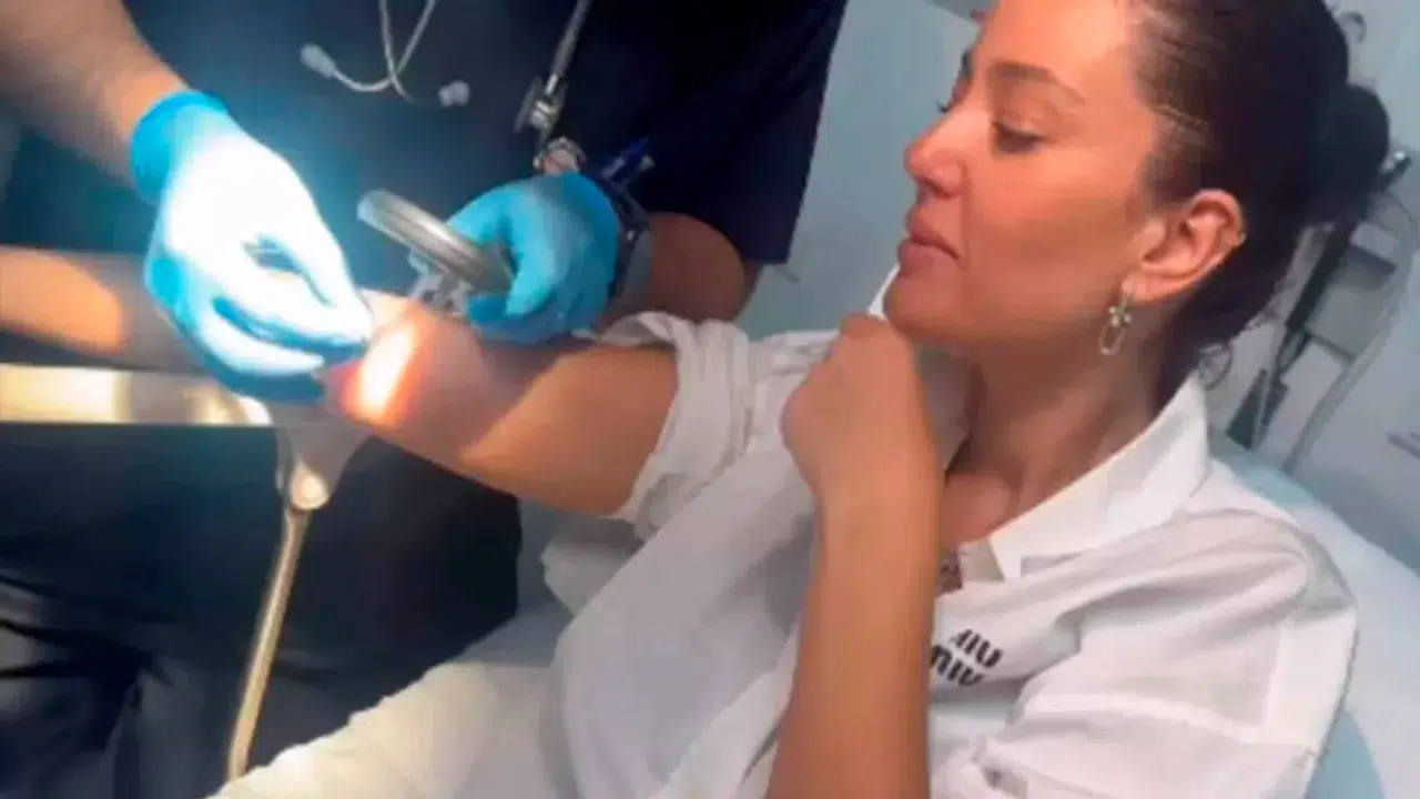 Koluna kene yapışan oyuncu Pelin Akil, böceği çıkarayım derken hastanelik oldu