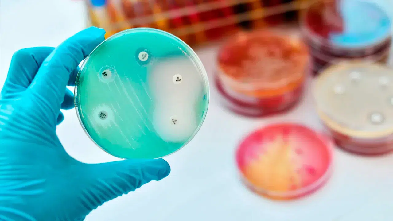 İklim krizi süper bakterileri besliyor: Antibiyotik direnci salmonellada yüzde 10 arttı