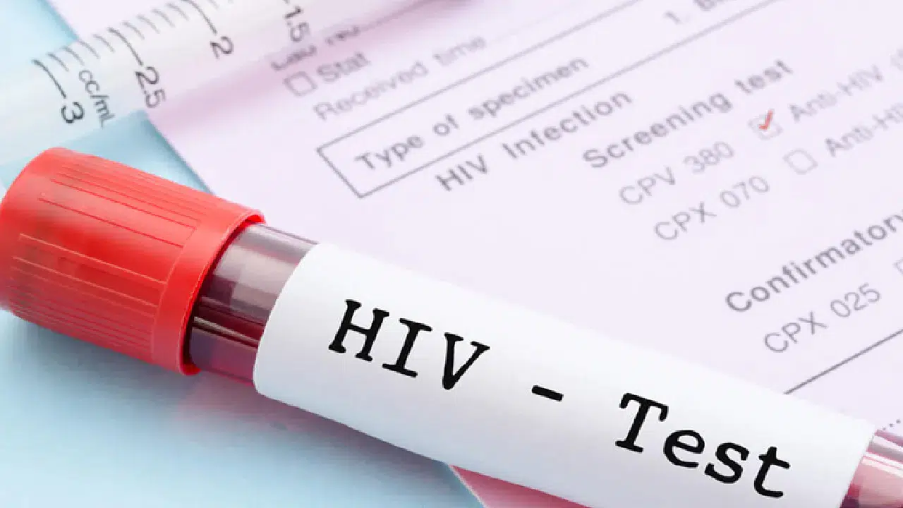 Eşinden HIV pozitif olduğunu gizledi: 10 ay hapis cezası onandı