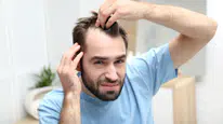 Erkek tipi saç dökülmesinde devrim! Yeni ilaç saç çıkışını yüzde 539 artırdı: 30 yılın en büyük ilerlemesi