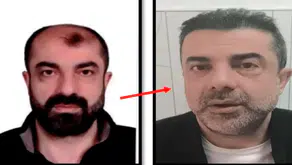 Cinayet şüphelisinden estetikli firar: Yüzünü değiştirdi ama adaletten kaçamadı