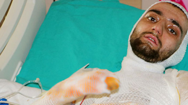 Sobaya benzin dökünce yandı