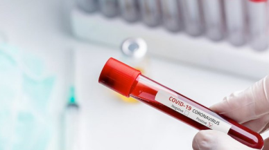 Ortak flüt kullandılar: 14 kişi pozitif çıktı