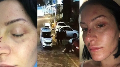 Polis tarafından dövülen Gökçe Yaşar konuştu