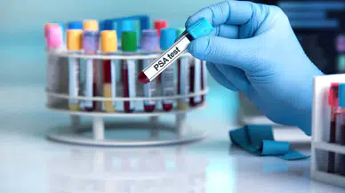 Avrupa’da 160 bin erkekle yapılan araştırma: PSA testi prostat kanserinden ölümleri azaltıyor