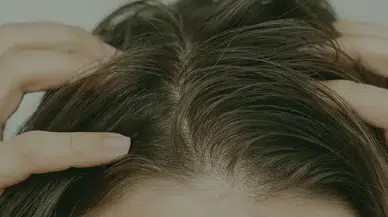 Yağlı saç derdi bitti! Uzmanlardan saçın yağlı görünmemesi için etkili tüyolar