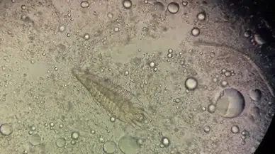 Siz uyurken yüzünüzde dolaşan misafirler: Demodeks gerçeği