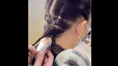 Kirpik için saç ektirdiler: Güzellikte sınırlar değişiyor