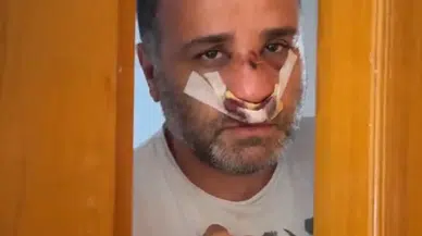 Marmaray'da çocuklarının yanında saldırıya uğrayan babadan ilk açıklama