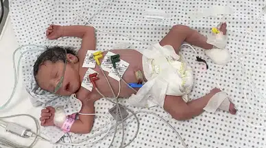 Gazze’de bebek mamaları tükendi: 48 saat içinde ölüm vakaları görülebilir