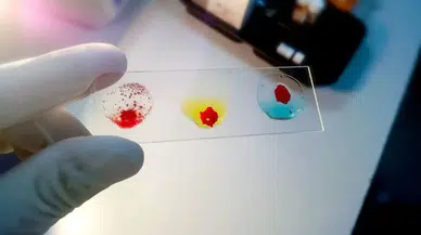 Fransa’da keşfedildi: Dünyanın 48. kan grubunun tek taşıyıcısı bir kadın