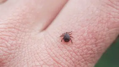Kene ısırması belirtileri nelerdir? Kene ısırığı olduğu nasıl fark edilir?
