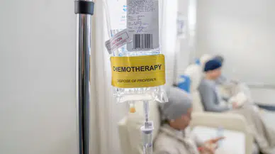 Kemoterapiye bağlı saç dökülmesine karşı “soğutma ve antioksidan”lı yeni yöntem